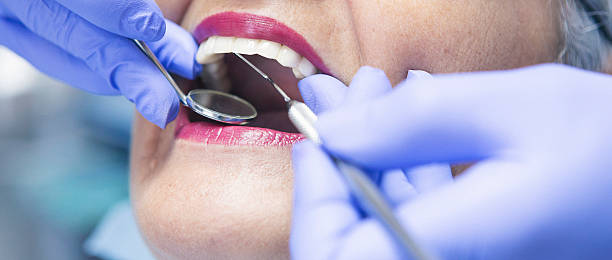 Best Emergency Dental Care for Abscessed Tooth in Cottageville, SC