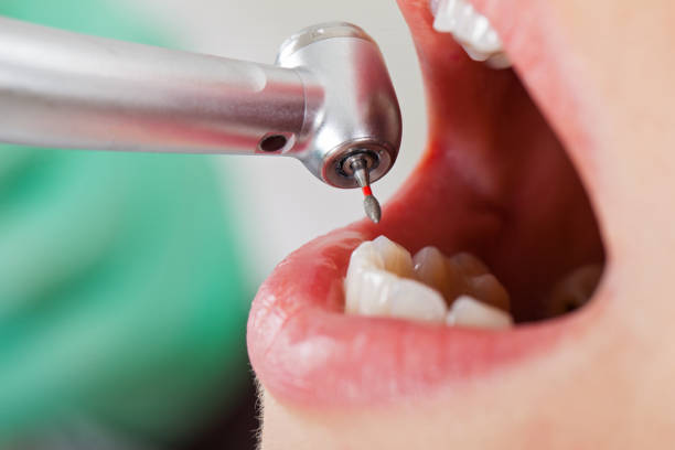 Best Orthodontic Emergency Dentist in Cottageville, SC